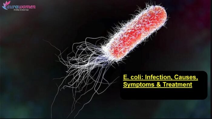 E. coli: Infection, Causes, Symptoms & Treatment | Aurawomen
